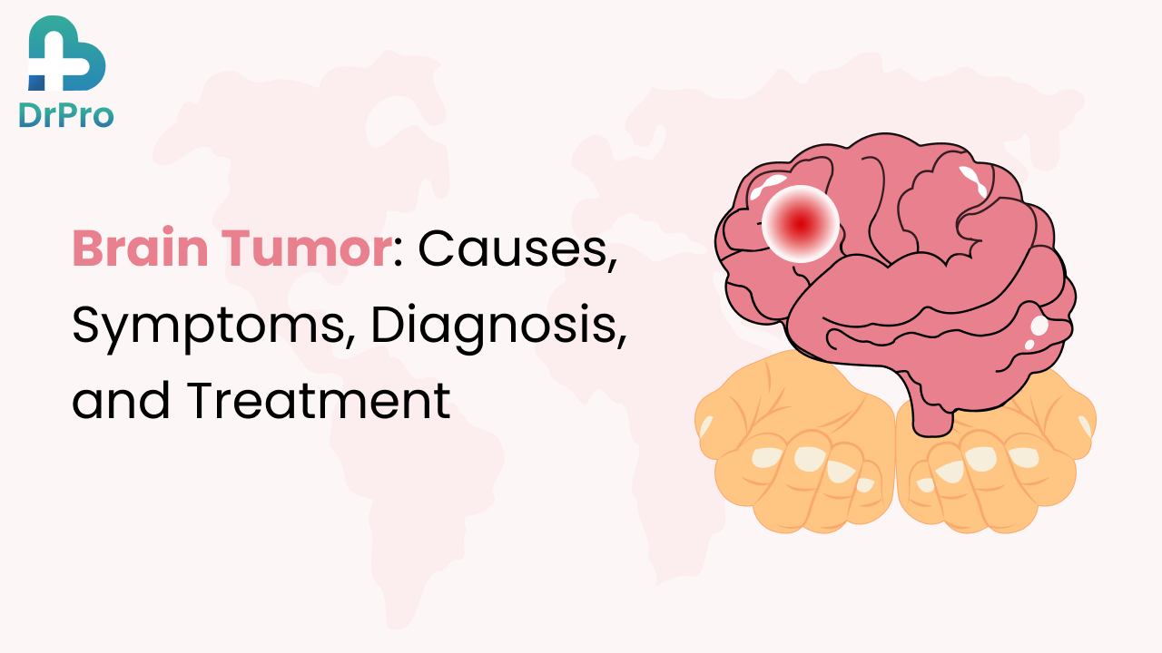 Brain Tumor: Causes, Symptoms, Diagnosis and Treatment