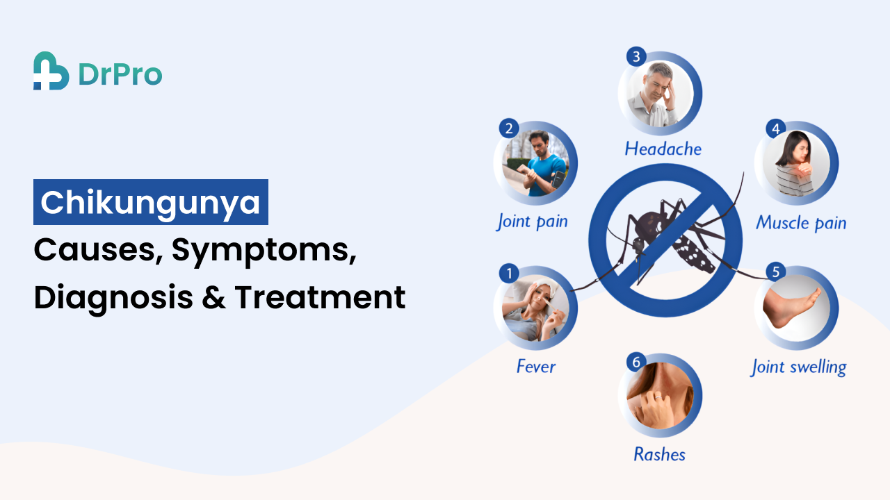 Chikungunya virus: Causes, Symptoms, Diagnosis & Treatment