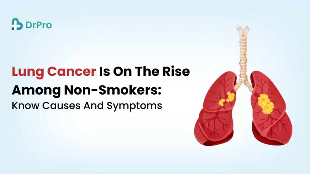 Lung cancer is on the rise among non-smokers_ know causes and symptoms - Wellness DrPro Health