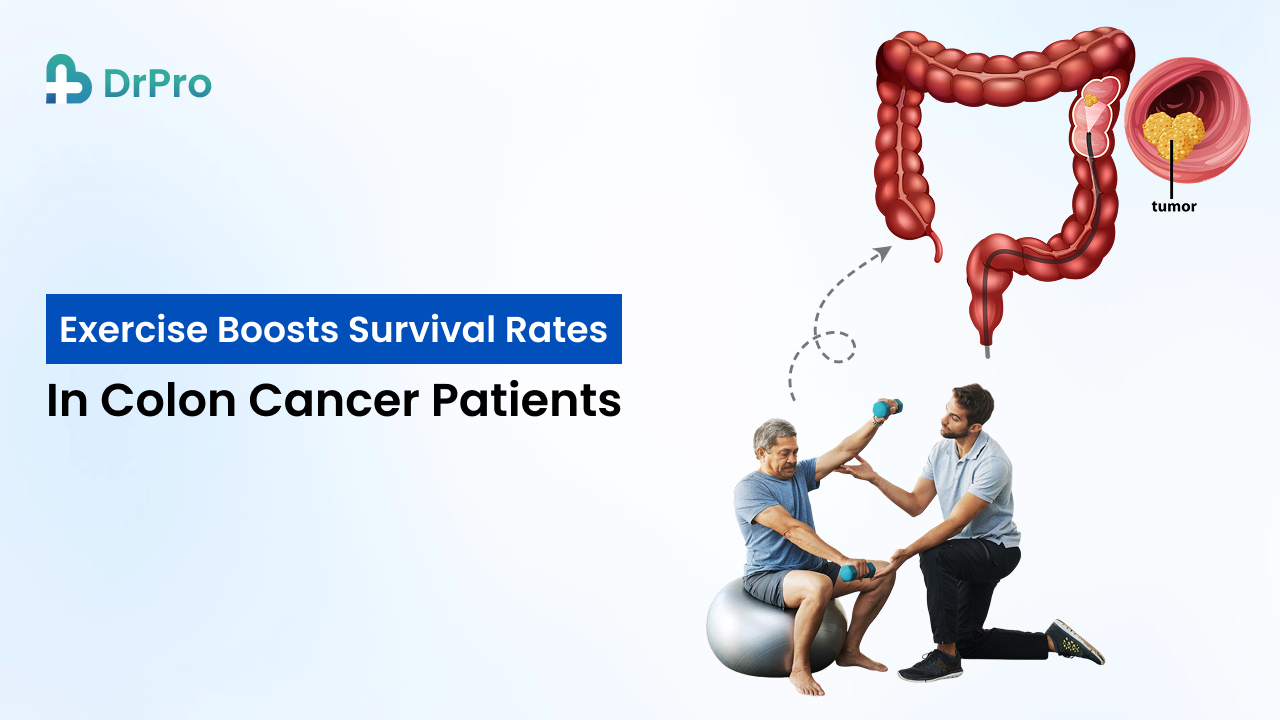 Exercise boosts survival rates in colon cancer patients